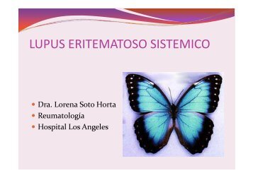 LUPUS ERITEMATOSO SISTEMICO