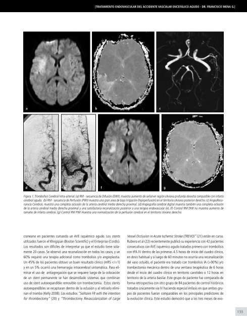 ClÃ­nica Las Condes / vol. 24 n0 1 / enero 2013