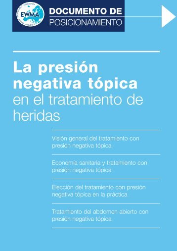 La presiÃƒÂ³n negativa tÃƒÂ³pica - EWMA