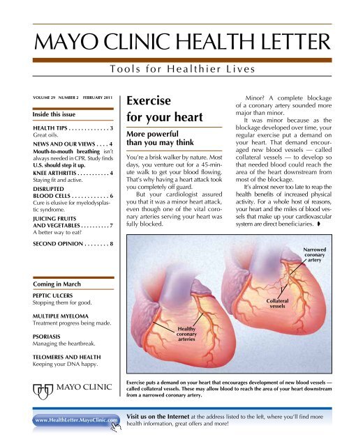 Juicing fruits and vegetables - Mayo Clinic Health Letter