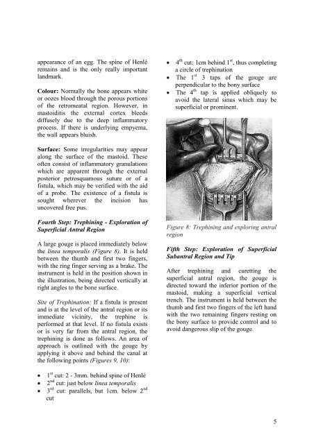 Hammer and gouge mastoidectomy for acute mastoiditis - Vula ...