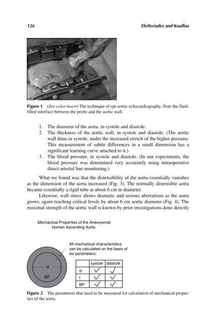 Acute Aortic Disease.. - Index of