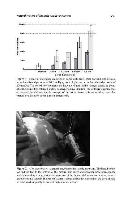 Acute Aortic Disease.. - Index of