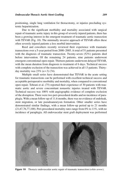 Acute Aortic Disease.. - Index of