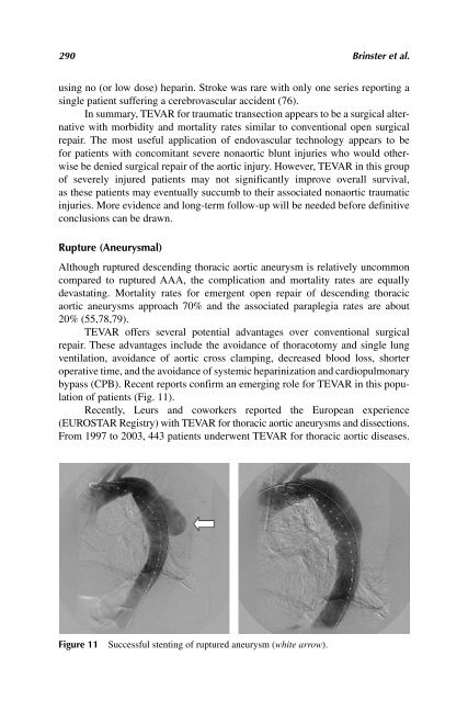 Acute Aortic Disease.. - Index of