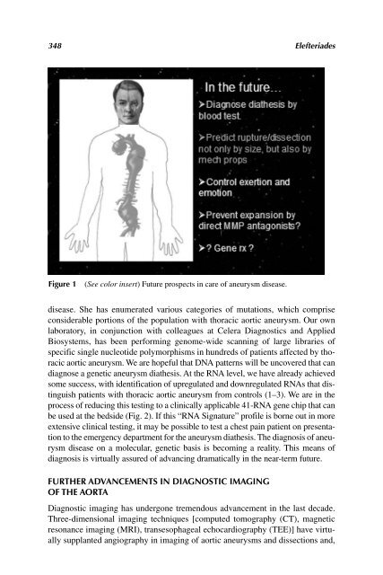 Acute Aortic Disease.. - Index of