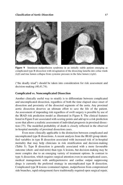 Acute Aortic Disease.. - Index of