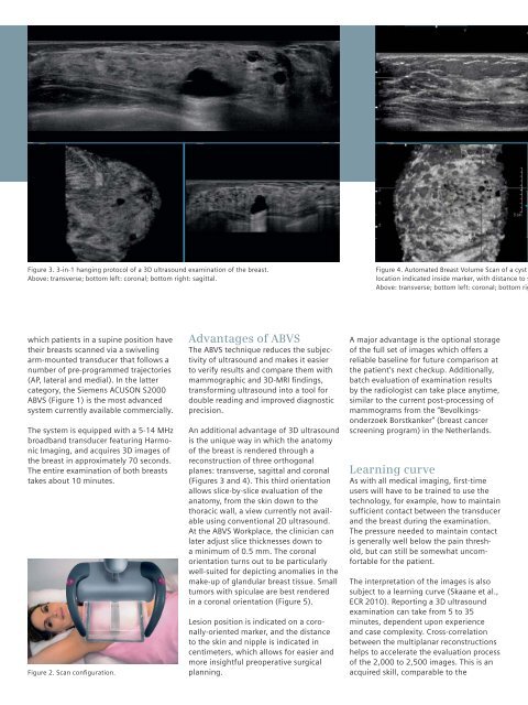 Automated Breast Volume Scanning 3D Ultrasound of the Breast
