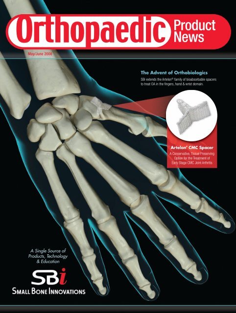 U.S. Orthopaedic Product News. May/June 2008. - Orthoworld