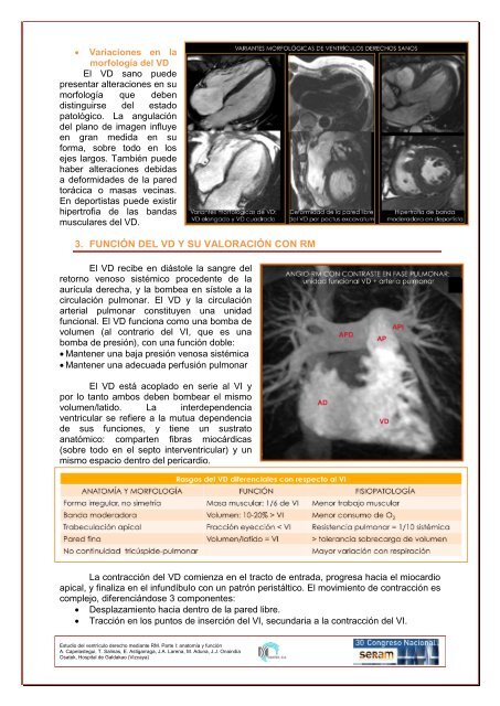 estudio del ventrículo derecho mediante resonancia magnética