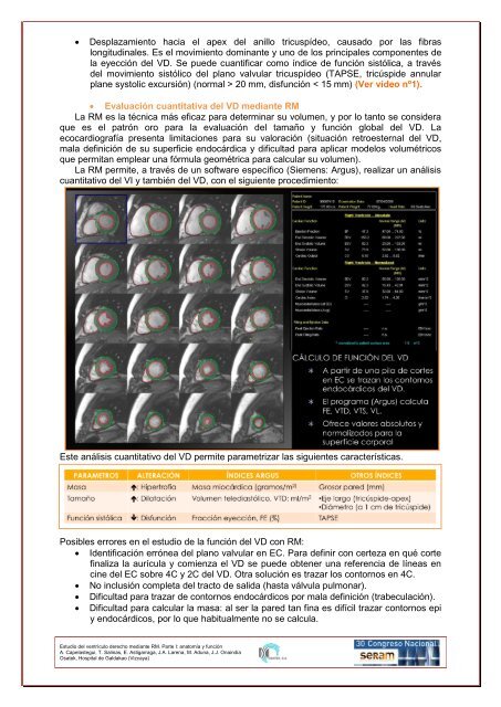 estudio del ventrículo derecho mediante resonancia magnética