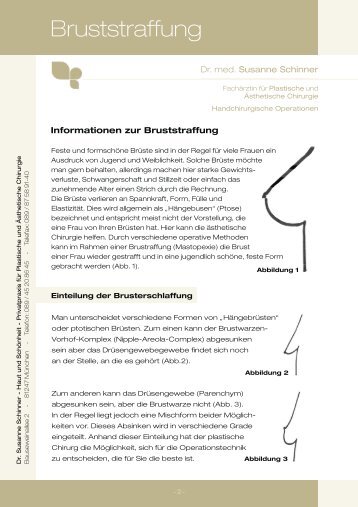 Informationen zur Bruststraffung - Dr. med. Susanne Schinner