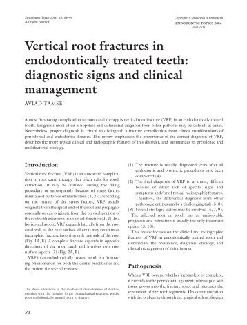 Vertical root fractures in endodontically treated teeth - College of ...