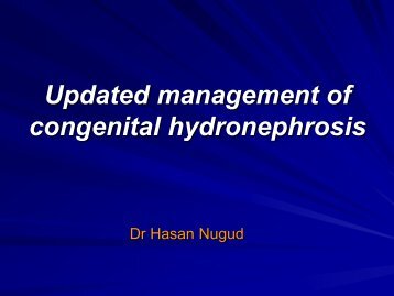 Management of Congenital Hydronephrosis - Dr. Nugud's
