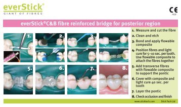 everStick®C&B fibre reinforced bridge for posterior ... - StickTech