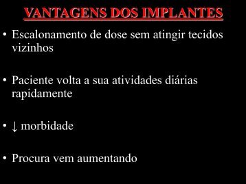 VANTAGENS DOS IMPLANTES - Comunidades