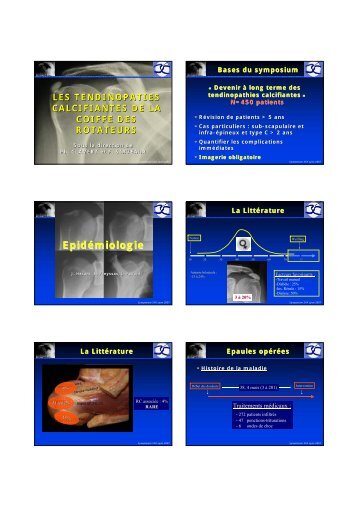Tendinopathie calcifiante de la coiffe des rotateurs - Ph. Clavert