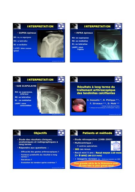 Tendinopathie calcifiante de la coiffe des rotateurs - Ph. Clavert