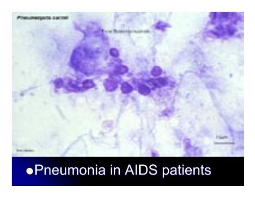 Kingdom Protista Powerpoint - Hamilton Local Schools