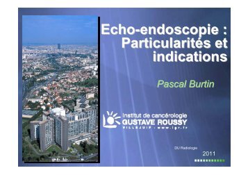 Echo-endoscopie : Particularités et indications