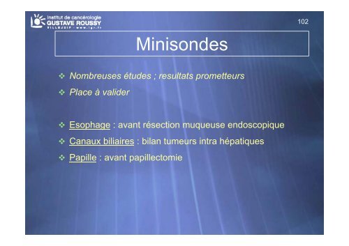 Echo-endoscopie : Particularités et indications