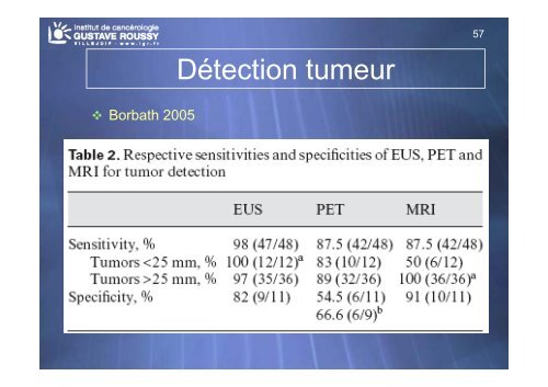 Echo-endoscopie : Particularités et indications