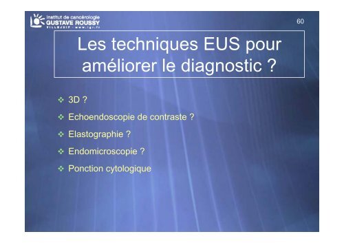 Echo-endoscopie : Particularités et indications