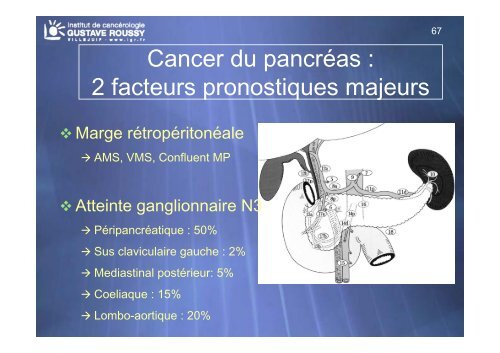 Echo-endoscopie : Particularités et indications