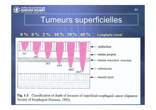 Echo-endoscopie : Particularités et indications