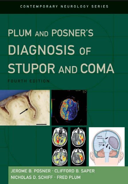 Plum And Posner S Diagnosis Of Stupor And Coma Pdf