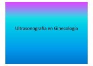 UltrasonograMa en Ginecología - IGBA