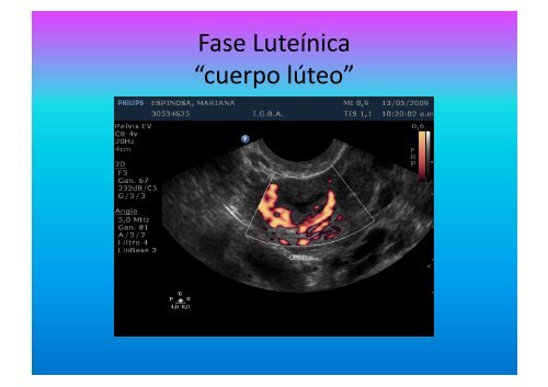 UltrasonograMa en Ginecología - IGBA