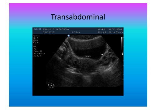 UltrasonograMa en Ginecología - IGBA