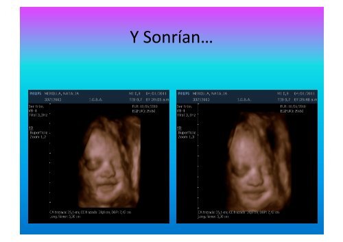 UltrasonograMa en Ginecología - IGBA