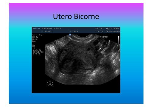 UltrasonograMa en Ginecología - IGBA