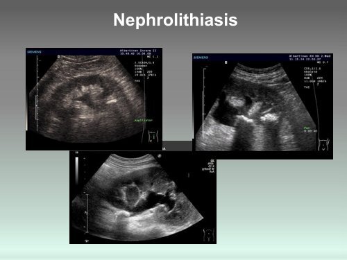 Sonographie - GeSRU