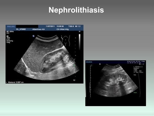 Sonographie - GeSRU