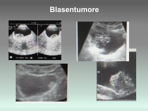 Sonographie - GeSRU