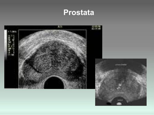 Sonographie - GeSRU