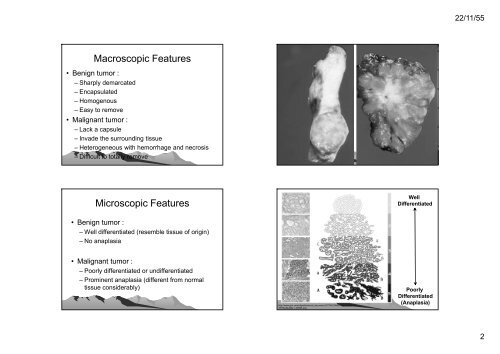 เนืองอก (Neoplasm)