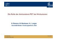 Die Rolle der Aminosäure-PET bei Hirntumoren - RWGN