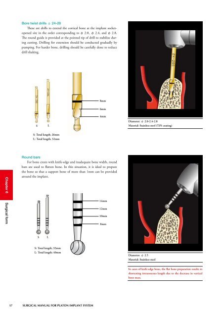 Untitled - Platon-implant.com