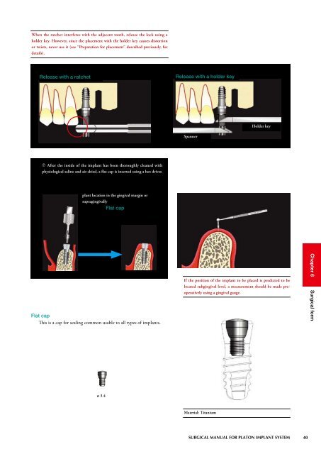 Untitled - Platon-implant.com