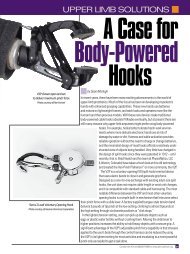 A Case for Body-Powered Hooks - Amputee Coalition