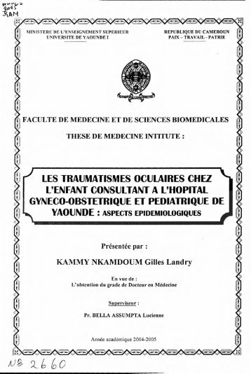 les traumatismes oculaires chez l'enfant consultant a l'hopital