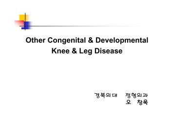 Congenital Pseudoarthrosis of Tibia