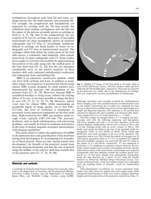 A high-resolution MRI study of linear growth of the human fetal skull ...