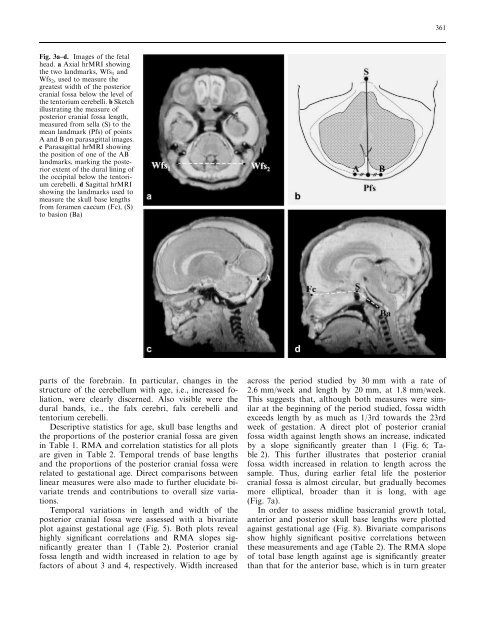 A high-resolution MRI study of linear growth of the human fetal skull ...