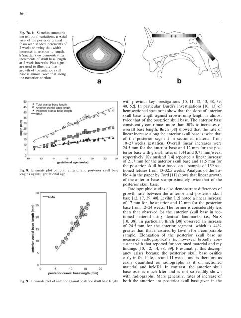 A high-resolution MRI study of linear growth of the human fetal skull ...