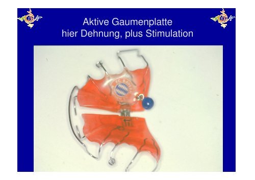 Störungen der Mundmotorik- als pdf-Datei - Oral-motorik.de